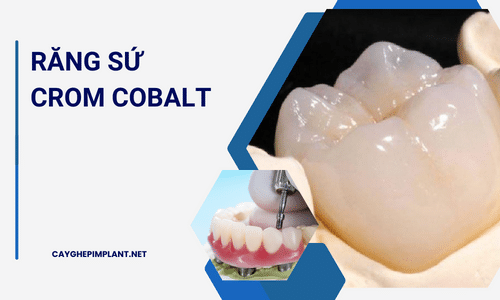 Răng sứ Crom Cobalt là gì ? Giá bao nhiêu ?