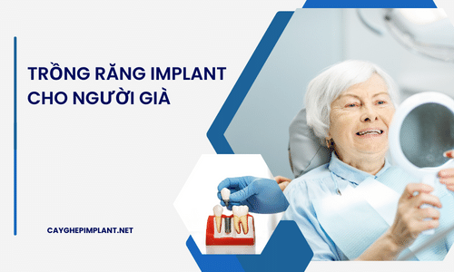 Trồng răng implant cho người già - Hướng tới tuổi thọ và sức khỏe