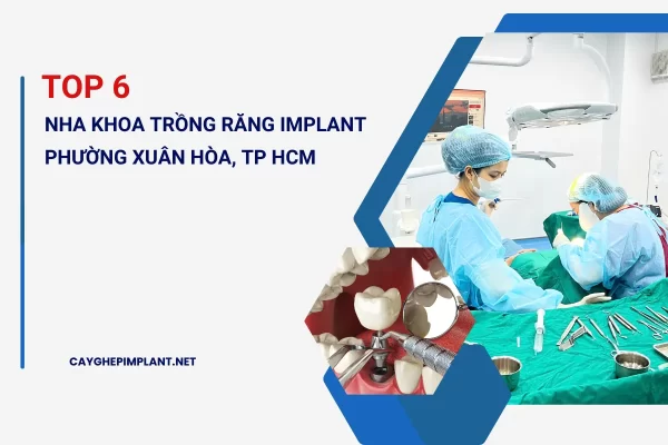 Top 6 Nha khoa trồng răng implant phường Xuân Hòa, Tp HCM