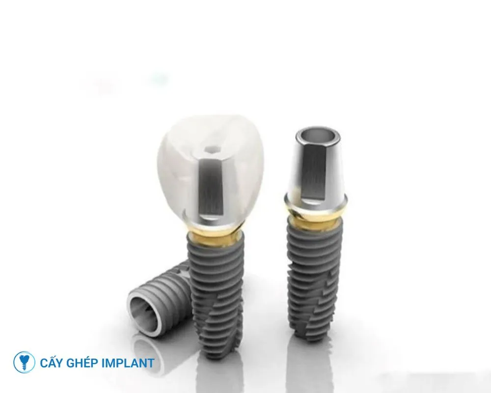 các loại trụ implant