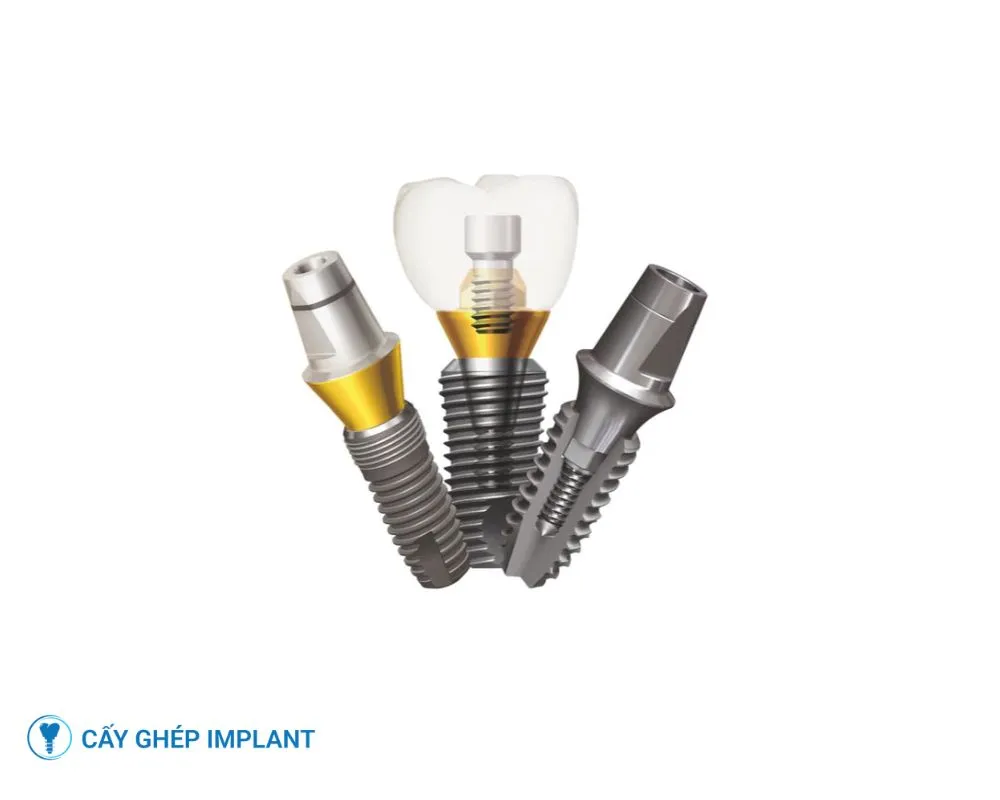 các loại trụ implant