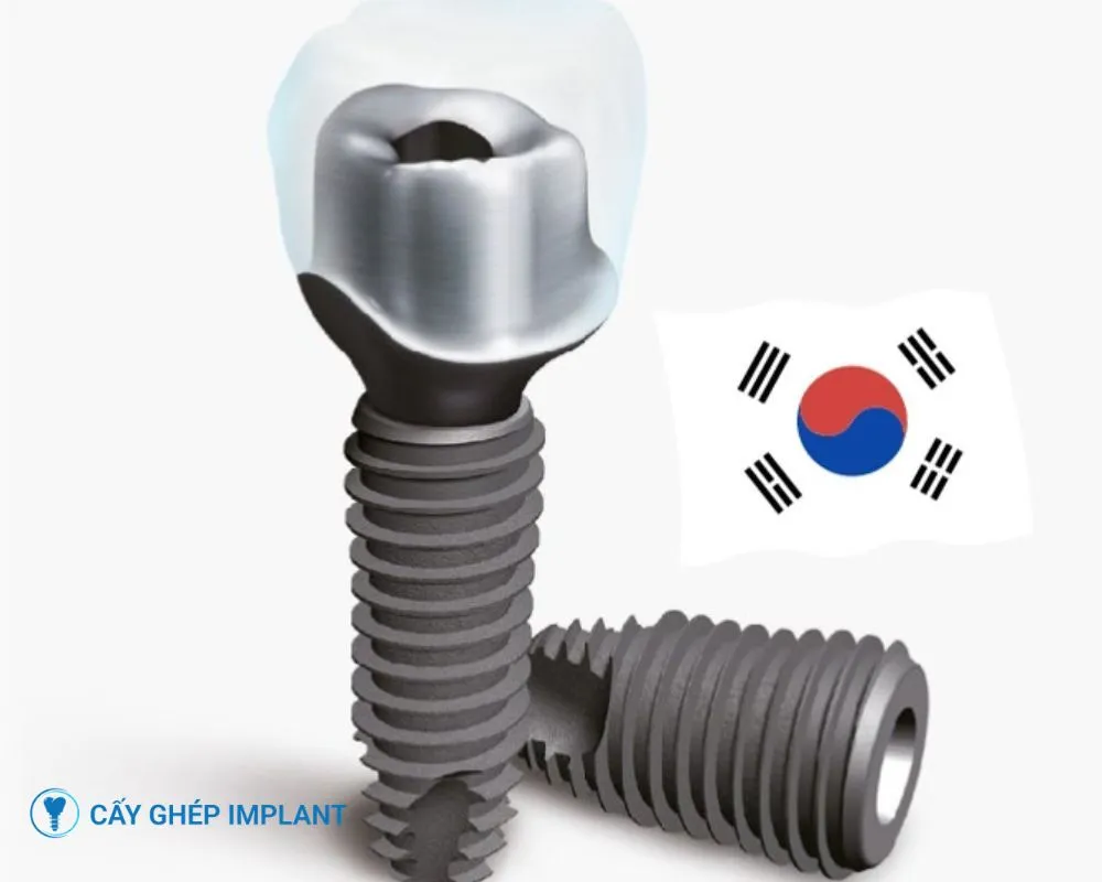 implant dio hàn quốc