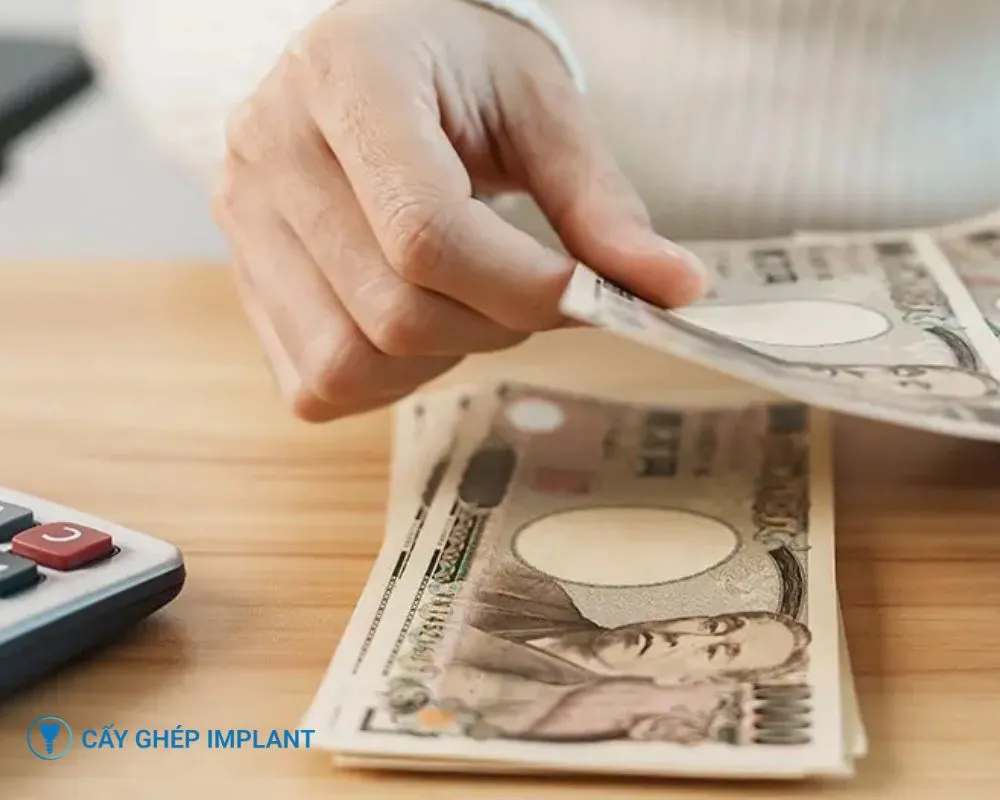 kinh nghiệm trồng răng implant