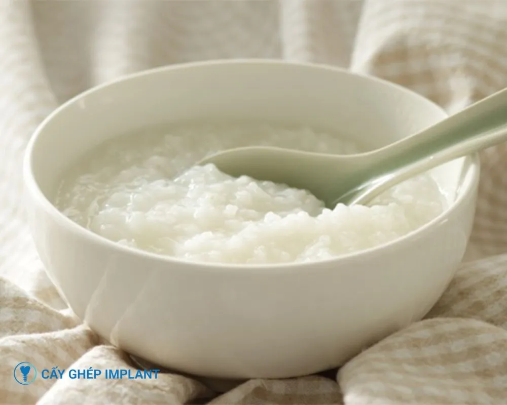 kinh nghiệm trồng răng implant