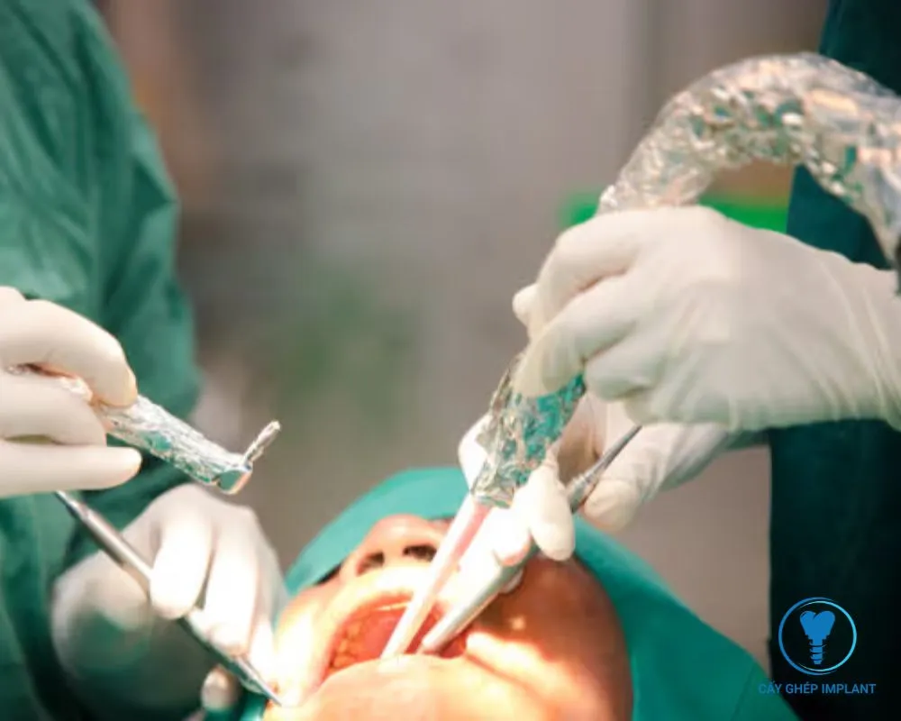 trồng implant răng cửa