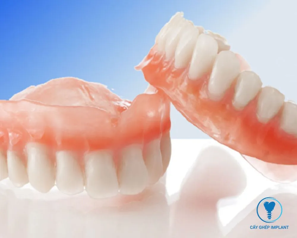 trồng răng bằng phương pháp implant