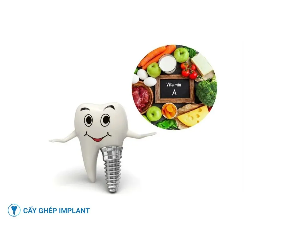 trồng răng implant bao lâu thì lành