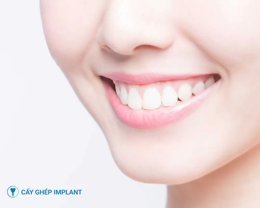 trồng răng implant có tốt không