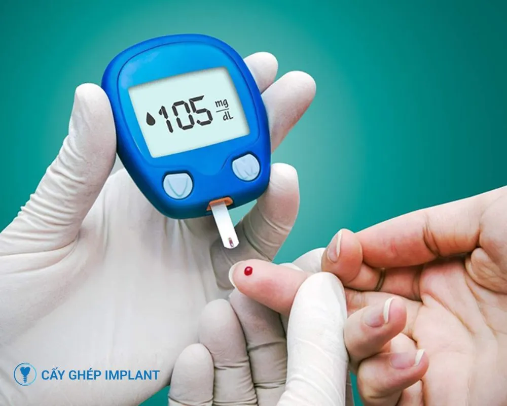 trồng răng implant có tốt không