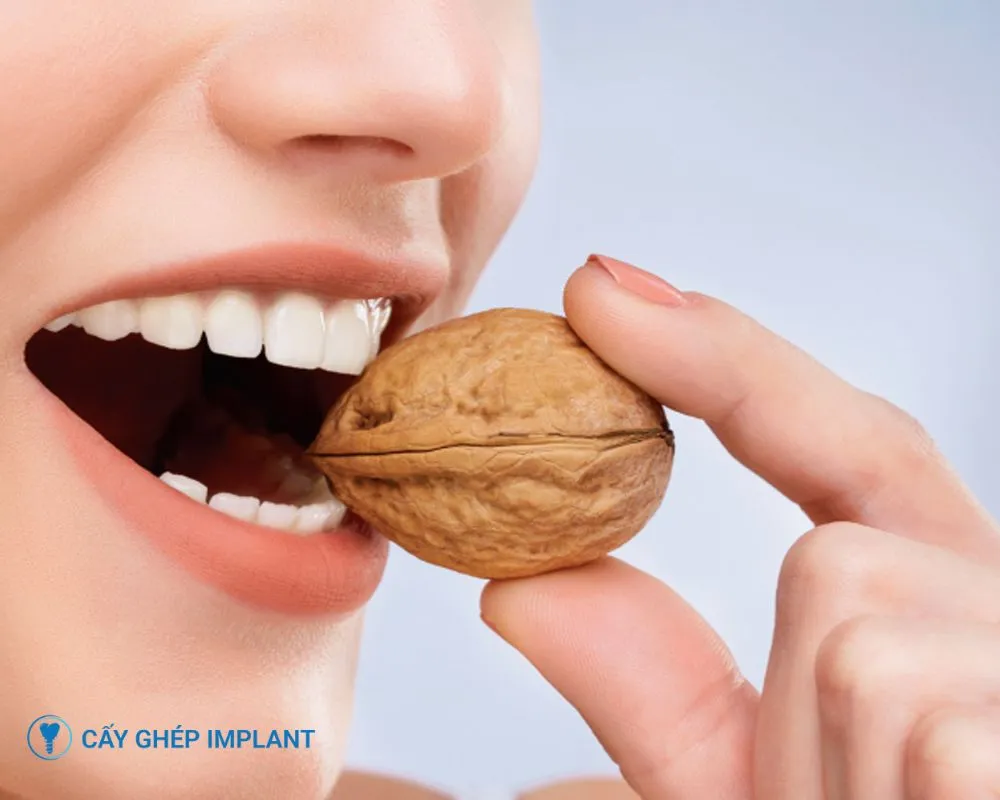 trồng răng implant có vĩnh viễn không