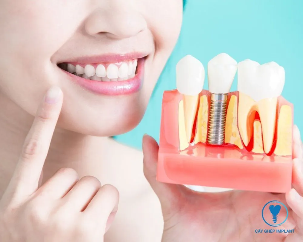 trồng răng implant không đau