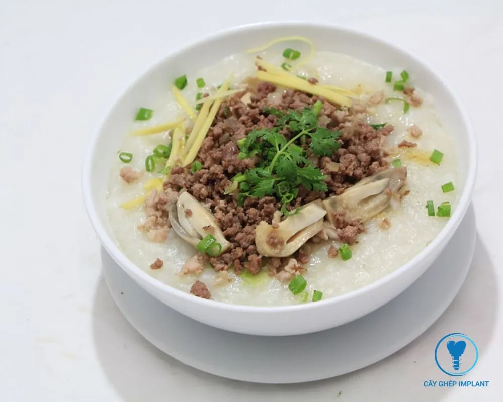 trồng răng implant kiêng ăn gì