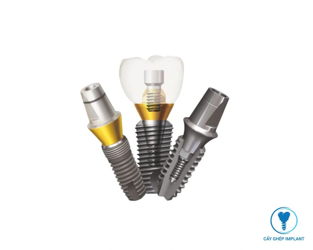 cấy implant răng số 6 bao nhiêu tiền
