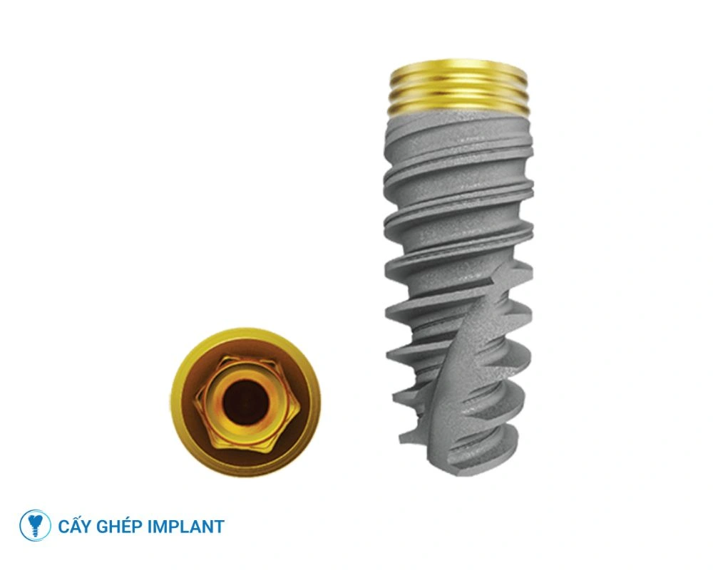 implant nobel