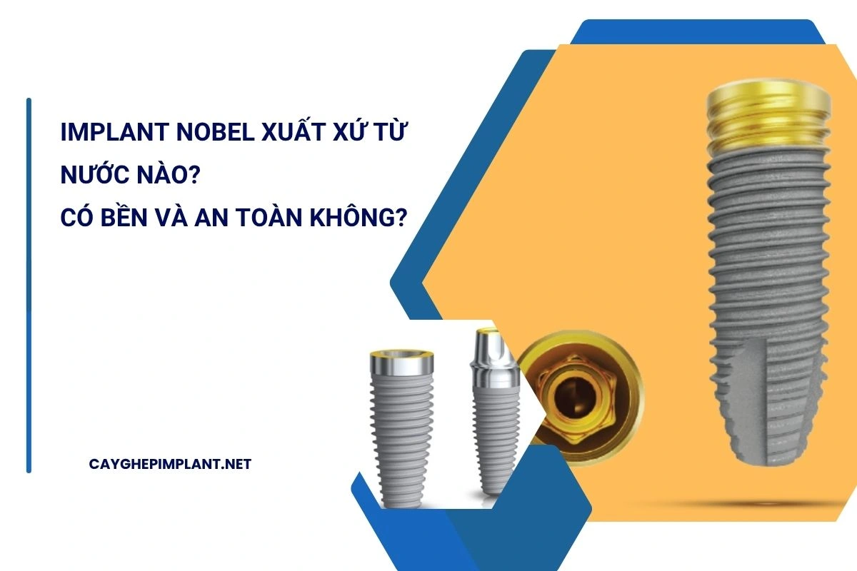 implant nobel