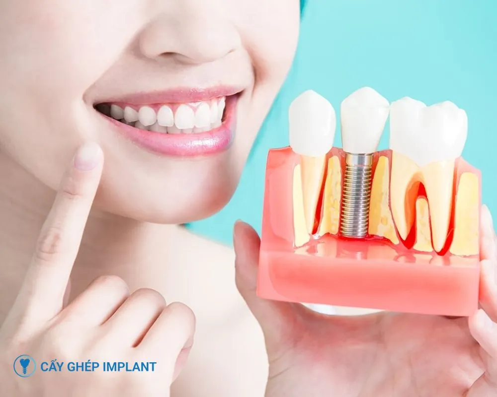 trồng răng implant nguyên hàm