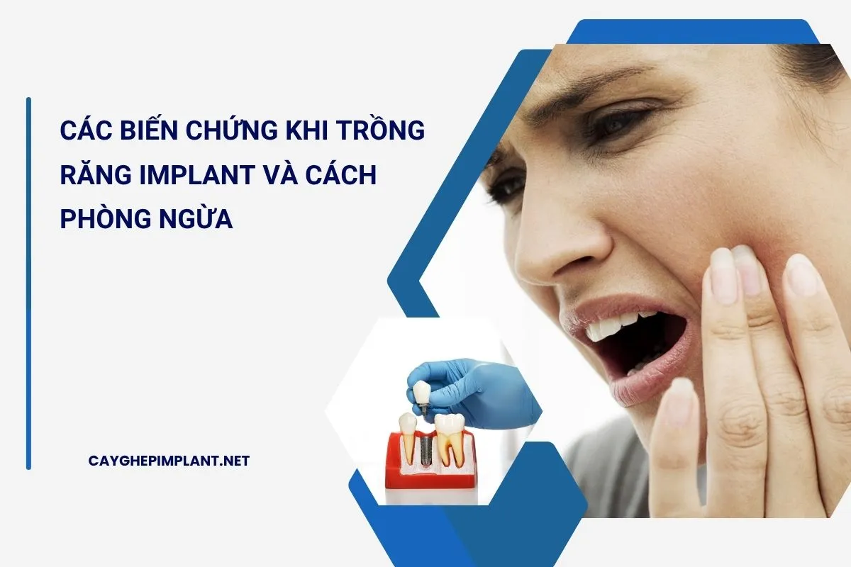 biến chứng khi trồng răng implant