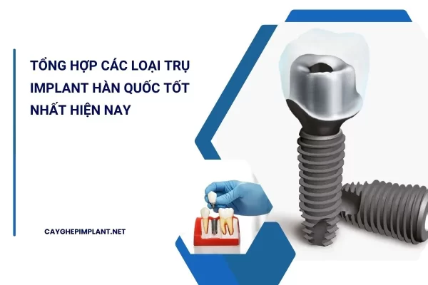 các loại trụ implant hàn quốc