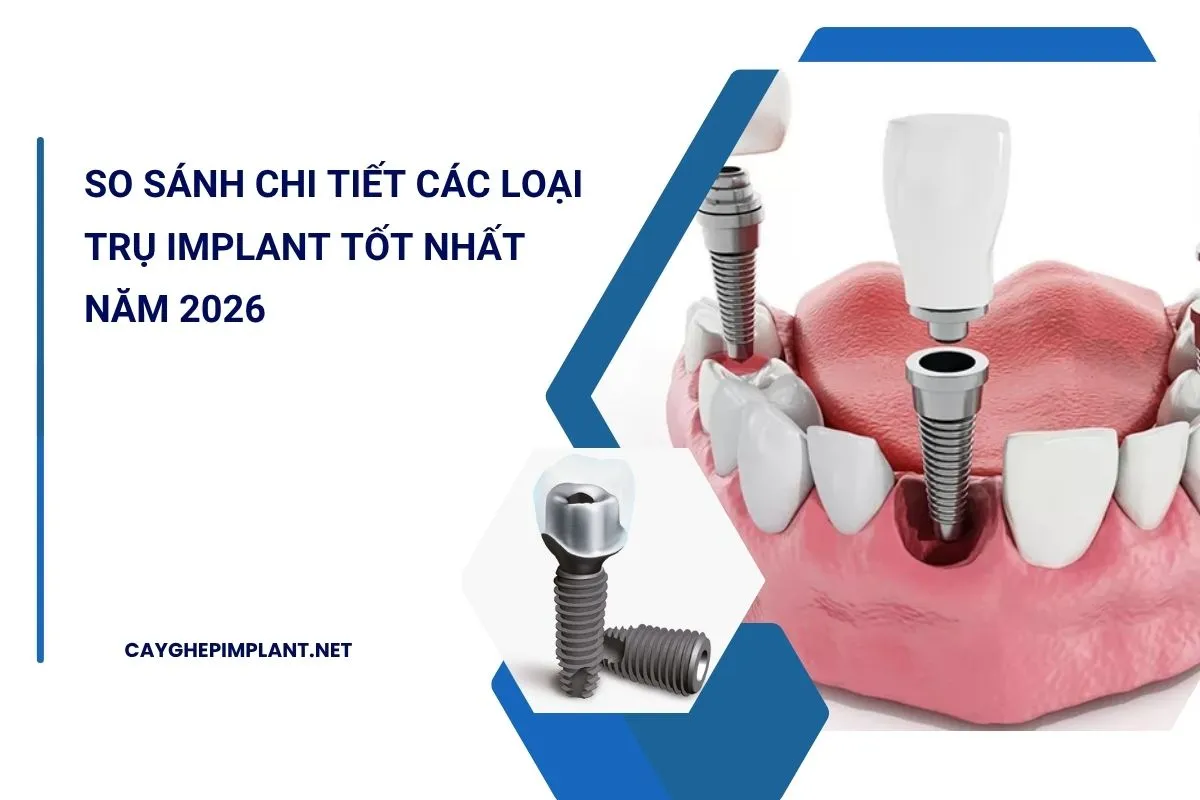 các loại trụ implant