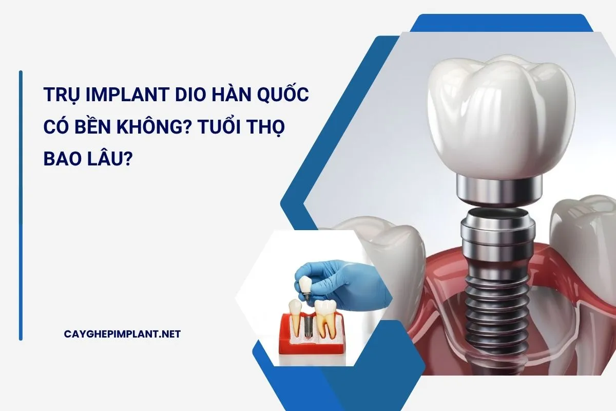 implant dio hàn quốc