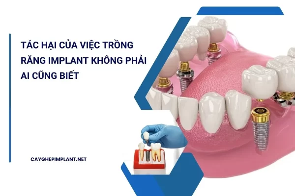 tác hại của việc trồng răng implant