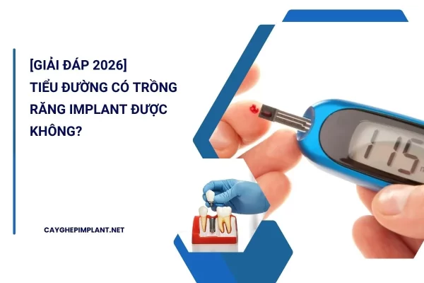 tiểu đường có trồng răng implant được không