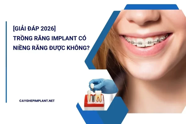 trồng răng implant có niềng răng được không