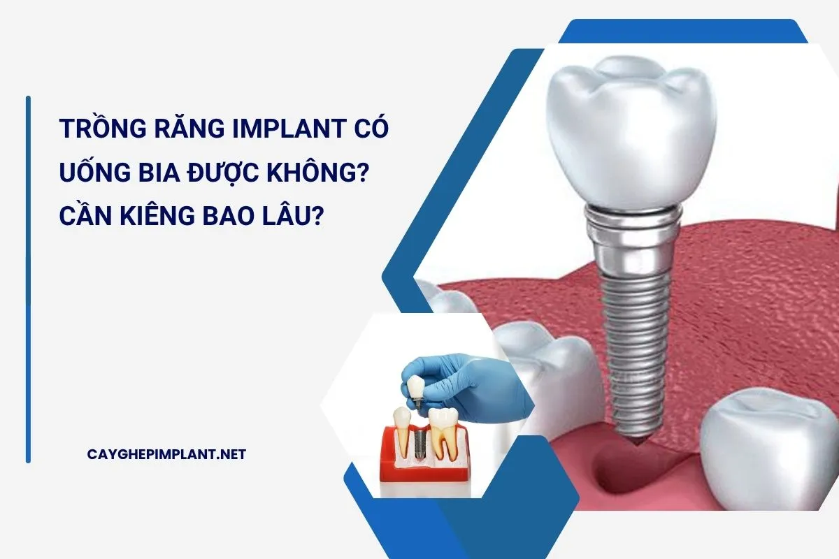 trồng răng implant có uống bia được không
