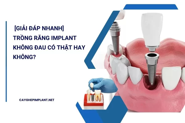 trồng răng implant không đau