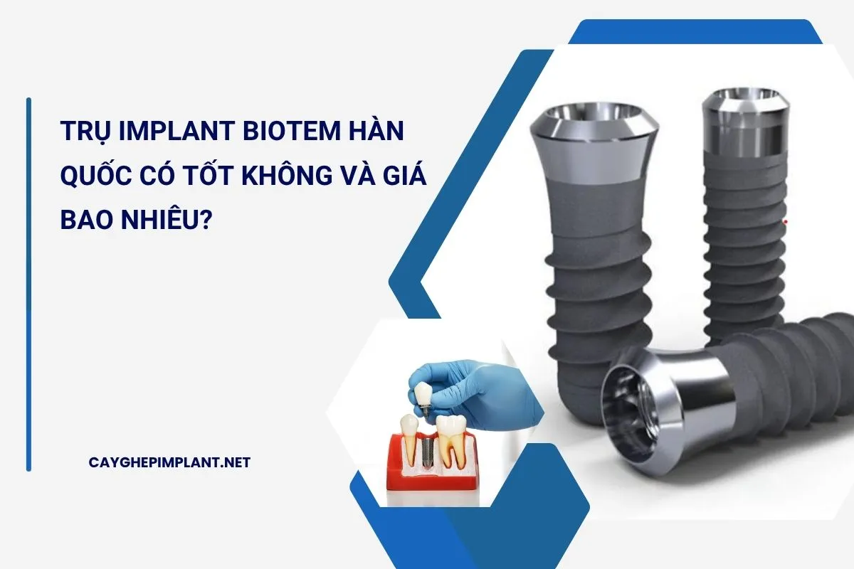 trụ implant biotem hàn quốc