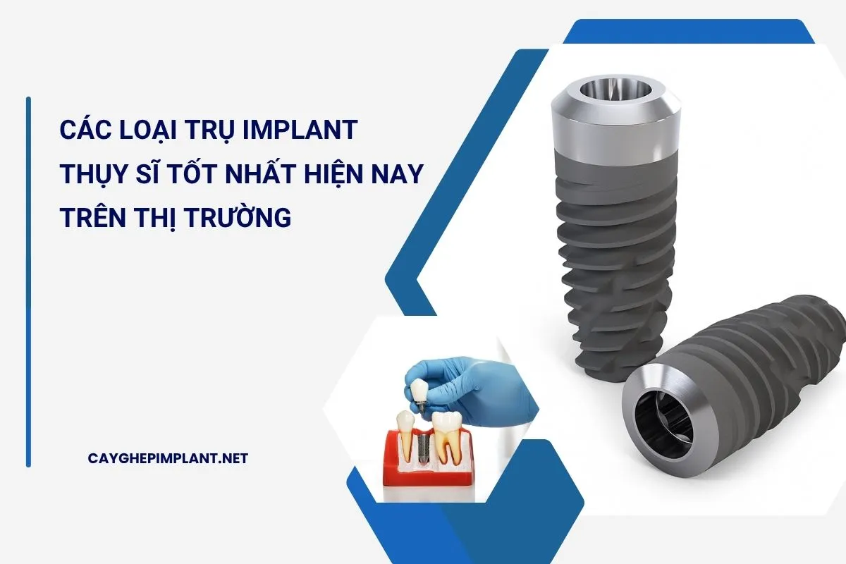 trụ implant thụy sĩ